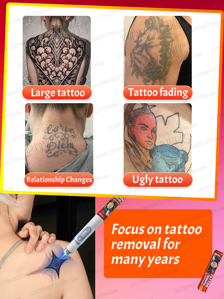 Nano laser tattooʀᴇᴍᴏᴠᴀʟ ᴘᴇɴ:  - Laser Toner Powder review and price